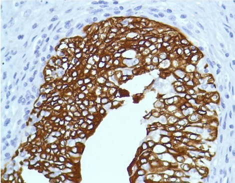 Anti-Cytokeratin 7 antibody [SP52] (ab183344) | Abcam