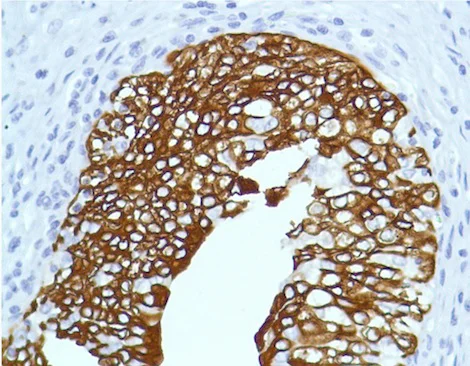 Immunohistochemistry (Formalin/PFA-fixed paraffin-embedded sections) - Anti-Cytokeratin 7 antibody [SP52] (AB183344)