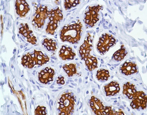 Anti-Cytokeratin 7 antibody [SP52] (ab183344) | Abcam