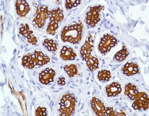 Immunohistochemistry (Formalin/PFA-fixed paraffin-embedded sections) - Anti-Cytokeratin 7 antibody [SP52] (AB183344)
