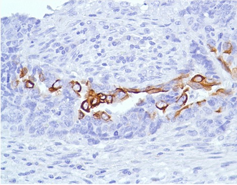 Anti-Cytokeratin 7 antibody [SP52] (ab183344) | Abcam