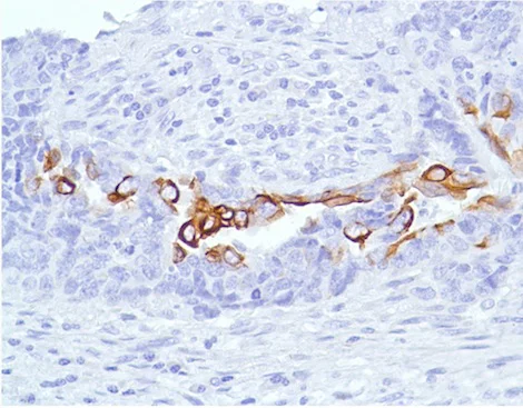 Immunohistochemistry (Formalin/PFA-fixed paraffin-embedded sections) - Anti-Cytokeratin 7 antibody [SP52] (AB183344)