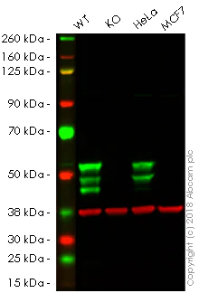 Western blot - Anti-Cytokeratin 7 antibody [SP52] (AB183344)