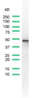 Western blot - Anti-Cytokeratin 7 antibody [SP52] (AB183344)