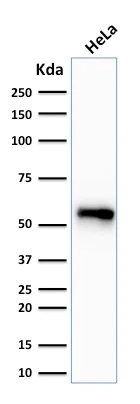 Western blot - Anti-Cytokeratin 7 antibody [SPM270] - BSA and Azide free (AB212526)