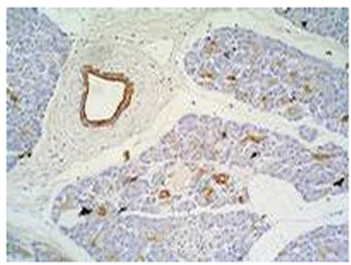 Immunohistochemistry (Formalin/PFA-fixed paraffin-embedded sections) - Anti-Cytokeratin 7+17 antibody [C-46] (AB670)