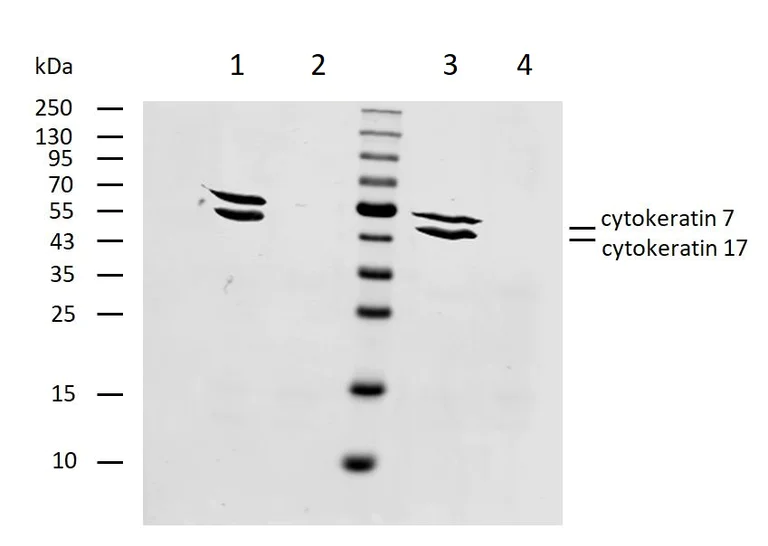 Western blot - Anti-Cytokeratin 7+17 antibody [C-46] (AB670)