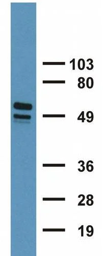 Western blot - Anti-Cytokeratin 7+17 antibody [C-46] (AB670)