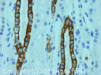 Immunohistochemistry (Formalin/PFA-fixed paraffin-embedded sections) - Anti-Cytokeratin 8 + 18 + 19 antibody [2A4] (AB41825)