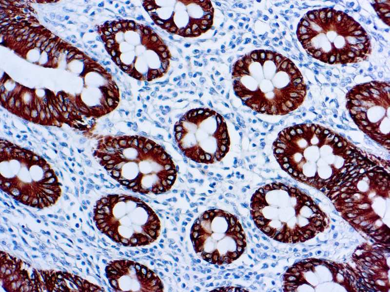 Immunohistochemistry (Formalin/PFA-fixed paraffin-embedded sections) - Anti-Cytokeratin 8 antibody [35bH11] (AB758), expandable thumbnail