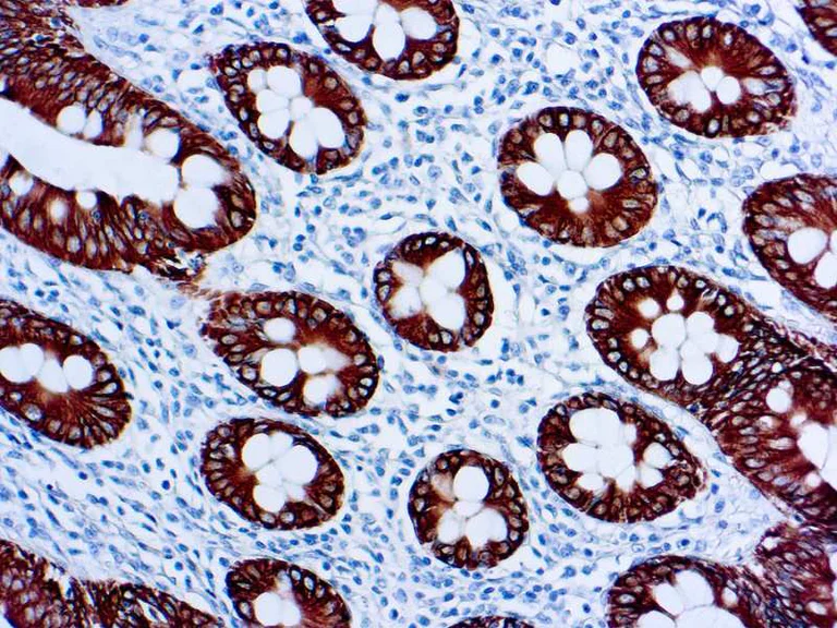 Immunohistochemistry (Formalin/PFA-fixed paraffin-embedded sections) - Anti-Cytokeratin 8 antibody [35bH11] (AB758)