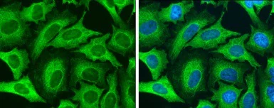 Immunocytochemistry/ Immunofluorescence - Anti-Cytokeratin 8 antibody (AB154301)