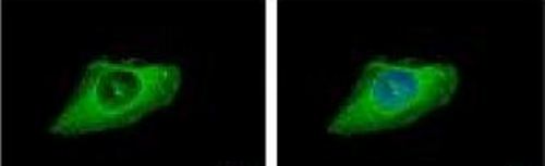 Immunocytochemistry/ Immunofluorescence - Anti-Cytokeratin 8 antibody (AB154301), expandable thumbnail
