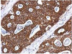 Immunohistochemistry (Formalin/PFA-fixed paraffin-embedded sections) - Anti-Cytokeratin 8 antibody (AB154301), expandable thumbnail
