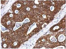 Immunohistochemistry (Formalin/PFA-fixed paraffin-embedded sections) - Anti-Cytokeratin 8 antibody (AB154301)