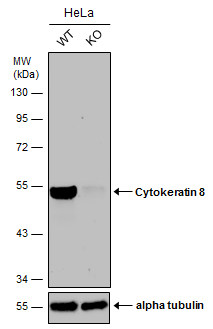 Western blot - Anti-Cytokeratin 8 antibody (AB154301), expandable thumbnail