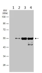 Western blot - Anti-Cytokeratin 8 antibody (AB154301)