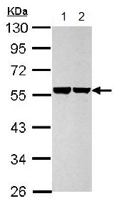 Western blot - Anti-Cytokeratin 8 antibody (AB154301), expandable thumbnail
