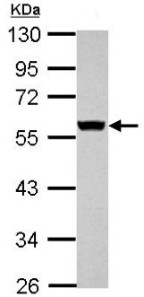 Western blot - Anti-Cytokeratin 8 antibody (AB154301), expandable thumbnail