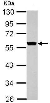 Western blot - Anti-Cytokeratin 8 antibody (AB154301)