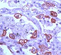 Immunohistochemistry (Formalin/PFA-fixed paraffin-embedded sections) - Anti-Cytokeratin 8 antibody (AB15465)