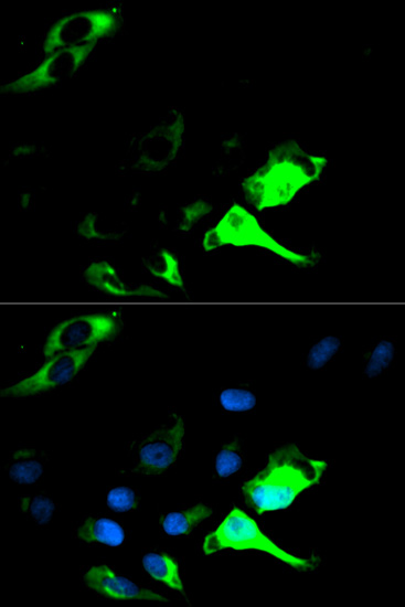 Immunocytochemistry/ Immunofluorescence - Anti-Cytokeratin 8 antibody (AB175249)