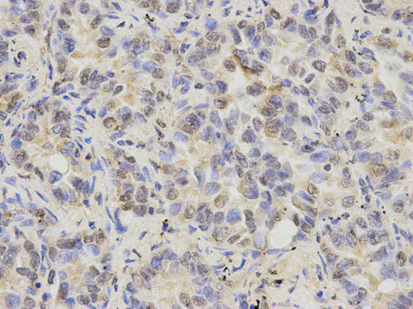 Immunohistochemistry (Formalin/PFA-fixed paraffin-embedded sections) - Anti-Cytokeratin 8 antibody (AB175249)