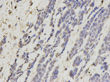 Immunohistochemistry (Formalin/PFA-fixed paraffin-embedded sections) - Anti-Cytokeratin 8 antibody (AB175249)