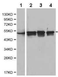 Western blot - Anti-Cytokeratin 8 antibody (AB175249)