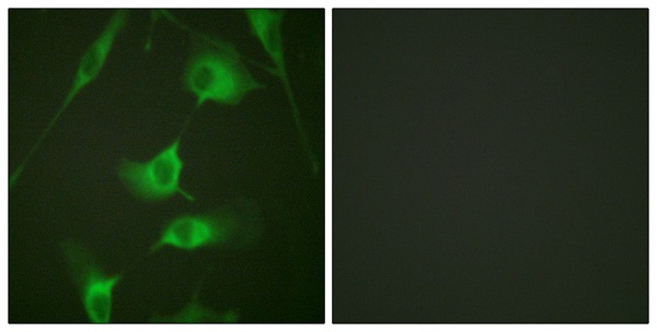 Immunocytochemistry/ Immunofluorescence - Anti-Cytokeratin 8 antibody (AB59400)