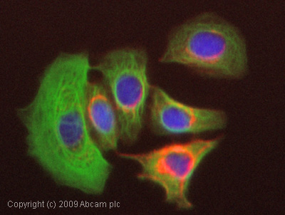 Anti-Cytokeratin 8 antibody