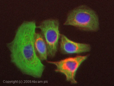 Immunocytochemistry/ Immunofluorescence - Anti-Cytokeratin 8 antibody (AB59400)