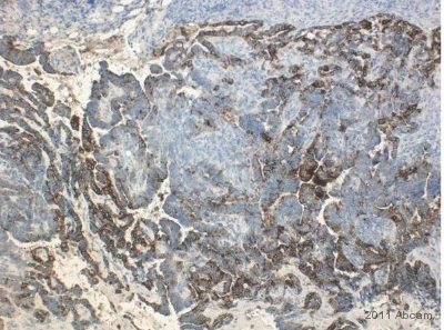 Immunohistochemistry (Formalin/PFA-fixed paraffin-embedded sections) - Anti-Cytokeratin 8 antibody (AB59400)