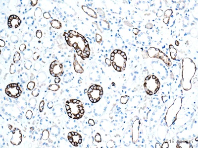 Immunohistochemistry (Formalin/PFA-fixed paraffin-embedded sections) - Anti-Cytokeratin 8 antibody (AB59400)