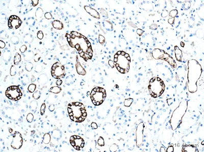 Immunohistochemistry (Formalin/PFA-fixed paraffin-embedded sections) - Anti-Cytokeratin 8 antibody (AB59400)