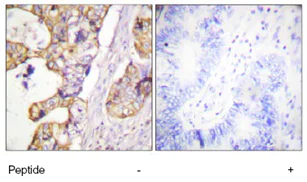 Immunohistochemistry (Formalin/PFA-fixed paraffin-embedded sections) - Anti-Cytokeratin 8 antibody (AB59400)