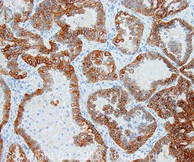 Immunohistochemistry (Formalin/PFA-fixed paraffin-embedded sections) - Anti-Cytokeratin 8 antibody [C-43] (AB2530), expandable thumbnail