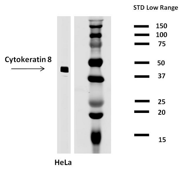 Western blot - Anti-Cytokeratin 8 antibody [C-43] (AB2530), expandable thumbnail