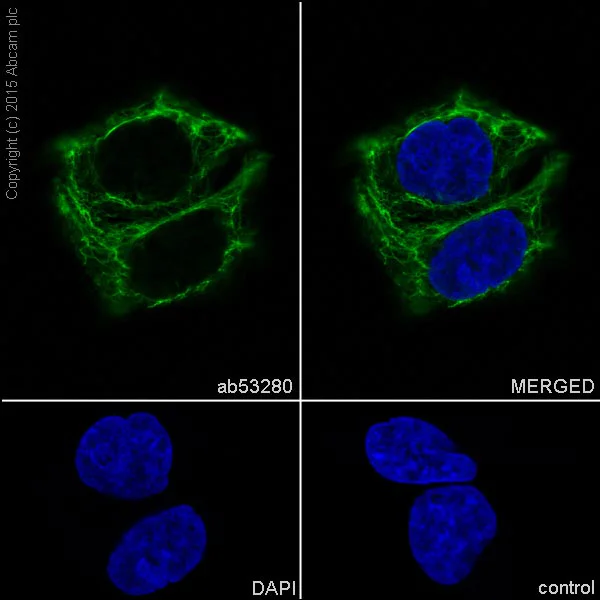 Immunocytochemistry/ Immunofluorescence - Anti-Cytokeratin 8 antibody [EP1628Y] - BSA and Azide free (AB217173)