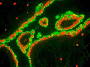 Immunohistochemistry (Formalin/PFA-fixed paraffin-embedded sections) - Anti-Cytokeratin 8 antibody [EP1628Y] - BSA and Azide free (AB217173)