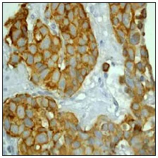 Immunohistochemistry (Formalin/PFA-fixed paraffin-embedded sections) - Anti-Cytokeratin 8 antibody [EP1628Y] - BSA and Azide free (AB217173)