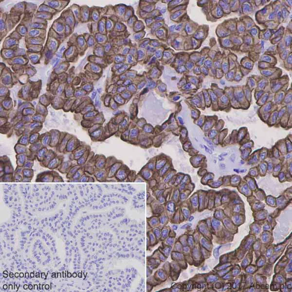 Immunohistochemistry (Formalin/PFA-fixed paraffin-embedded sections) - Anti-Cytokeratin 8 antibody [EP1628Y] - BSA and Azide free (AB217173)