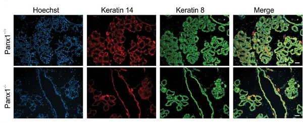 Immunohistochemistry (Formalin/PFA-fixed paraffin-embedded sections) - Anti-Cytokeratin 8 antibody [EP1628Y] - BSA and Azide free (AB217173)