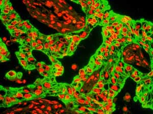 Immunohistochemistry (Formalin/PFA-fixed paraffin-embedded sections) - Anti-Cytokeratin 8 antibody [EP1628Y] - BSA and Azide free (AB217173)