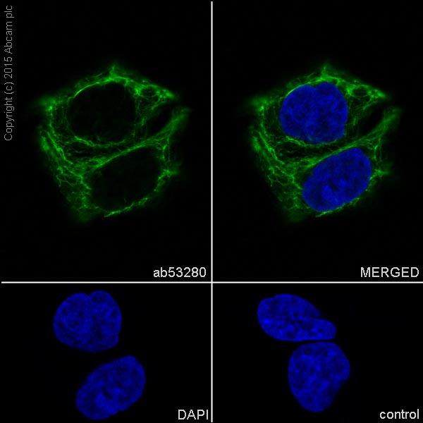 Immunocytochemistry/ Immunofluorescence - Anti-Cytokeratin 8 antibody [EP1628Y] - Cytoskeleton Marker (ab53280), expandable thumbnail