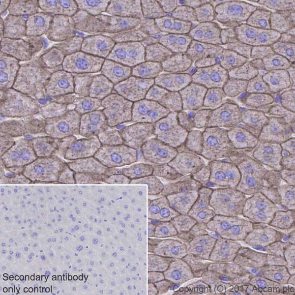 Immunohistochemistry (Formalin/PFA-fixed paraffin-embedded sections) - Anti-Cytokeratin 8 antibody [EP1628Y] - Cytoskeleton Marker (ab53280), expandable thumbnail