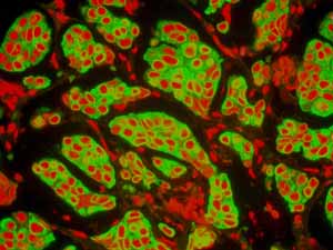 Immunohistochemistry (Formalin/PFA-fixed paraffin-embedded sections) - Anti-Cytokeratin 8 antibody [EP1628Y] - Cytoskeleton Marker (ab53280), expandable thumbnail