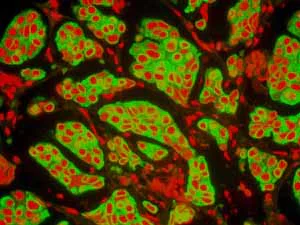 Immunohistochemistry (Formalin/PFA-fixed paraffin-embedded sections) - Anti-Cytokeratin 8 antibody [EP1628Y] - Cytoskeleton Marker (AB53280)