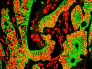 Immunohistochemistry (Formalin/PFA-fixed paraffin-embedded sections) - Anti-Cytokeratin 8 antibody [EP1628Y] - Cytoskeleton Marker (AB53280)