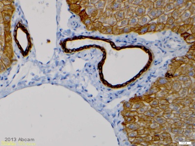 Immunohistochemistry (Formalin/PFA-fixed paraffin-embedded sections) - Anti-Cytokeratin 8 antibody [EP1628Y] - Cytoskeleton Marker (ab53280), expandable thumbnail
